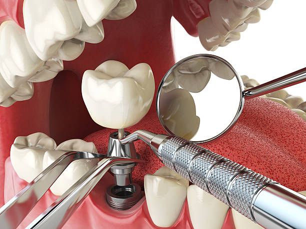 Best Emergency Tooth Extraction  in Lincolnia, VA